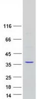 Human CAPZB / CAPZ Beta Protein (Recombinant Myc-DDK (Flag))