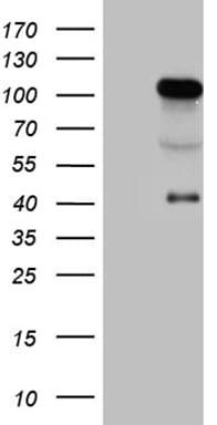 TCF12 / HEB Antibody (clone OTI4A7)