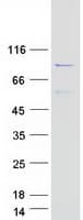Human ADD2 Protein (Recombinant Myc-DDK (Flag))