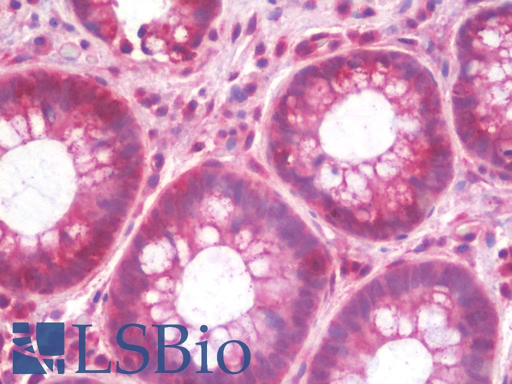 IHC-plus™ MRPL54 Antibody (aa81-130)