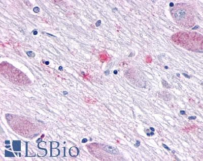 PathPlus™ SGK3 Antibody (N-Terminus)
