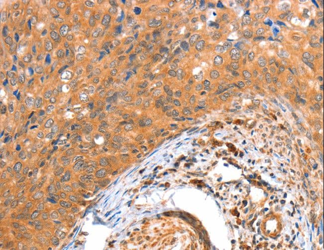 Polyclonal Rabbit anti-Human ACOX3 Antibody (IHC)