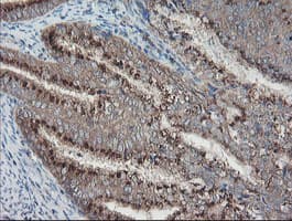 GCP60 / ACBD3 Antibody (clone OTI5F9)