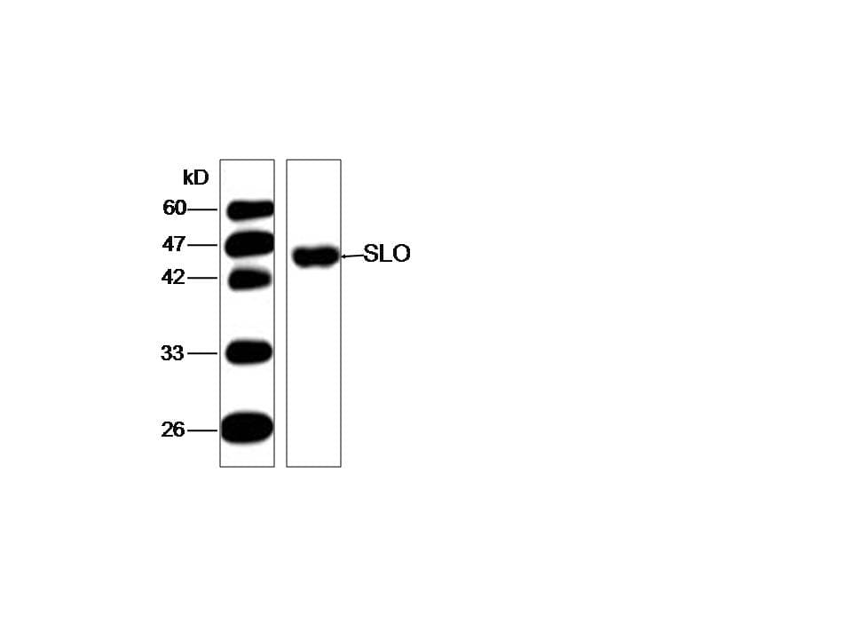 Streptolysin O Antibody (aa78-206)