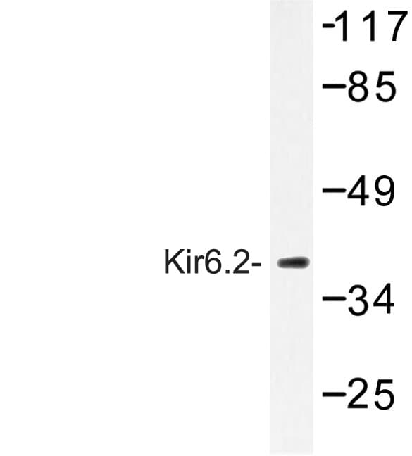 KCNJ11 / Kir6.2 Antibody (Val220)