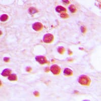 ZNF232 Antibody (Internal)
