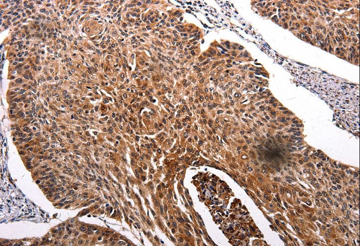 Polyclonal Rabbit anti-Human RAB41 Antibody (IHC)