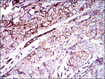 CD59 Antibody (Amino Acid: 31-111, clone 8D2B8)