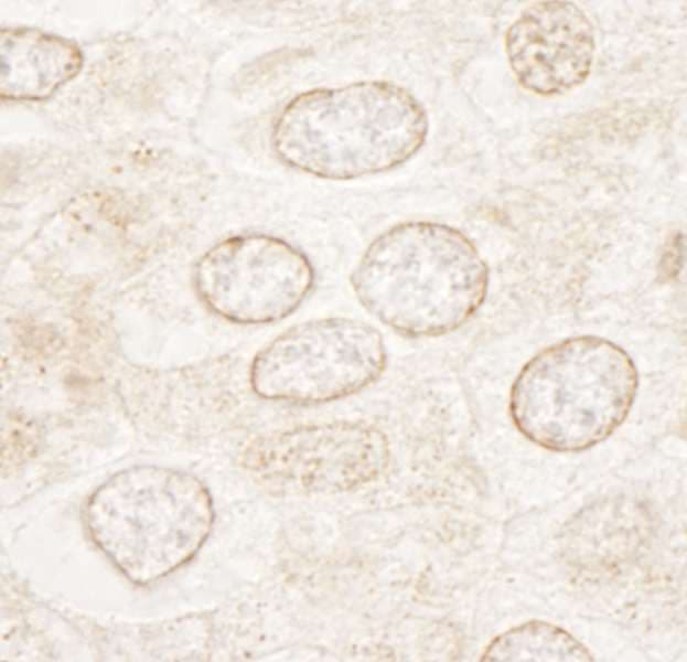 WDFY3 / ALFY Antibody (aa500-550)
