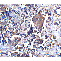 IL1RL1 Antibody
