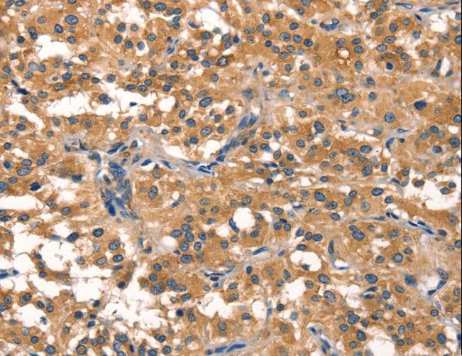 EIF4G1 / EIF4G Antibody