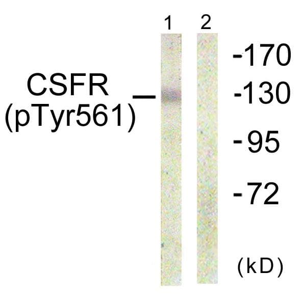 CSF1R / CD115 / FMS Antibody (phospho-Tyr561)