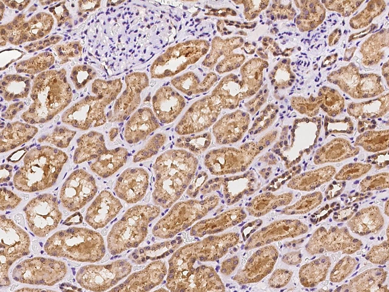 ARHGAP22 / RhoGAP2 Antibody