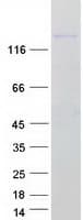 Human FAM160A1 Protein (Recombinant Myc-DDK (Flag))
