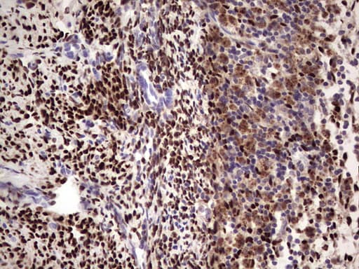 PR / Progesterone Receptor Antibody (aa1-298, clone OTI26C2, Carrier-free)