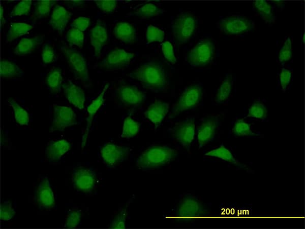 ZHX2 / RAF Antibody (clone 5E2)