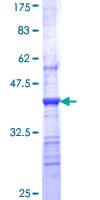 Human CHRNB1 Protein (Recombinant GST, N-terminus)