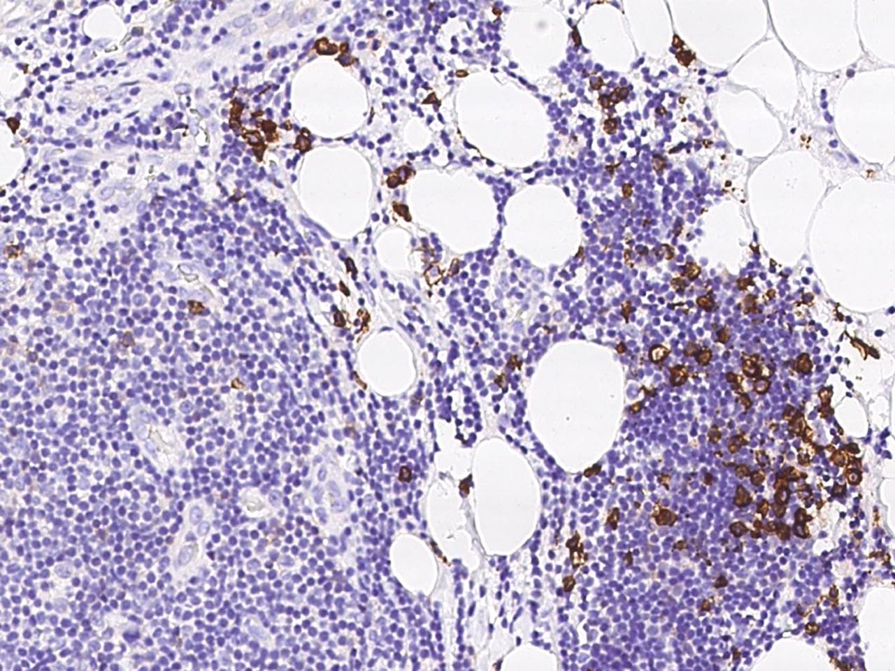 CD38 Antibody (Preservative Free)