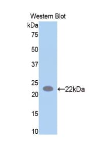 SPTAN1 / Alpha Fodrin Antibody (aa1004-1181)