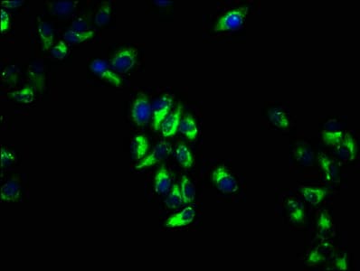 IHC-plus™ Polyclonal Rabbit anti-Human VTCN1 / B7-H4 Antibody (IHC, WB)