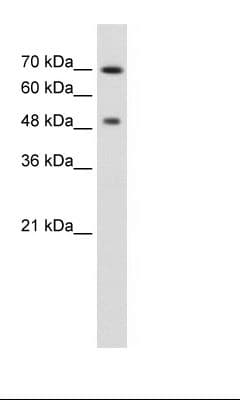 RAD23A / HHR23A Antibody (aa141-190)