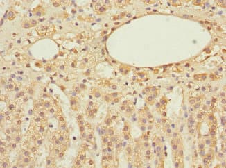 Polyclonal Rabbit anti-Human EIF3S5 / EIF3F Antibody (IHC)