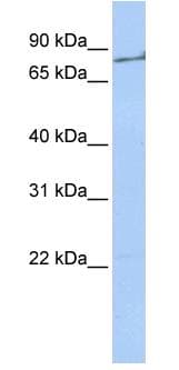 IHC-plus™ F2 / Prothrombin / Thrombin Antibody (aa396-445)