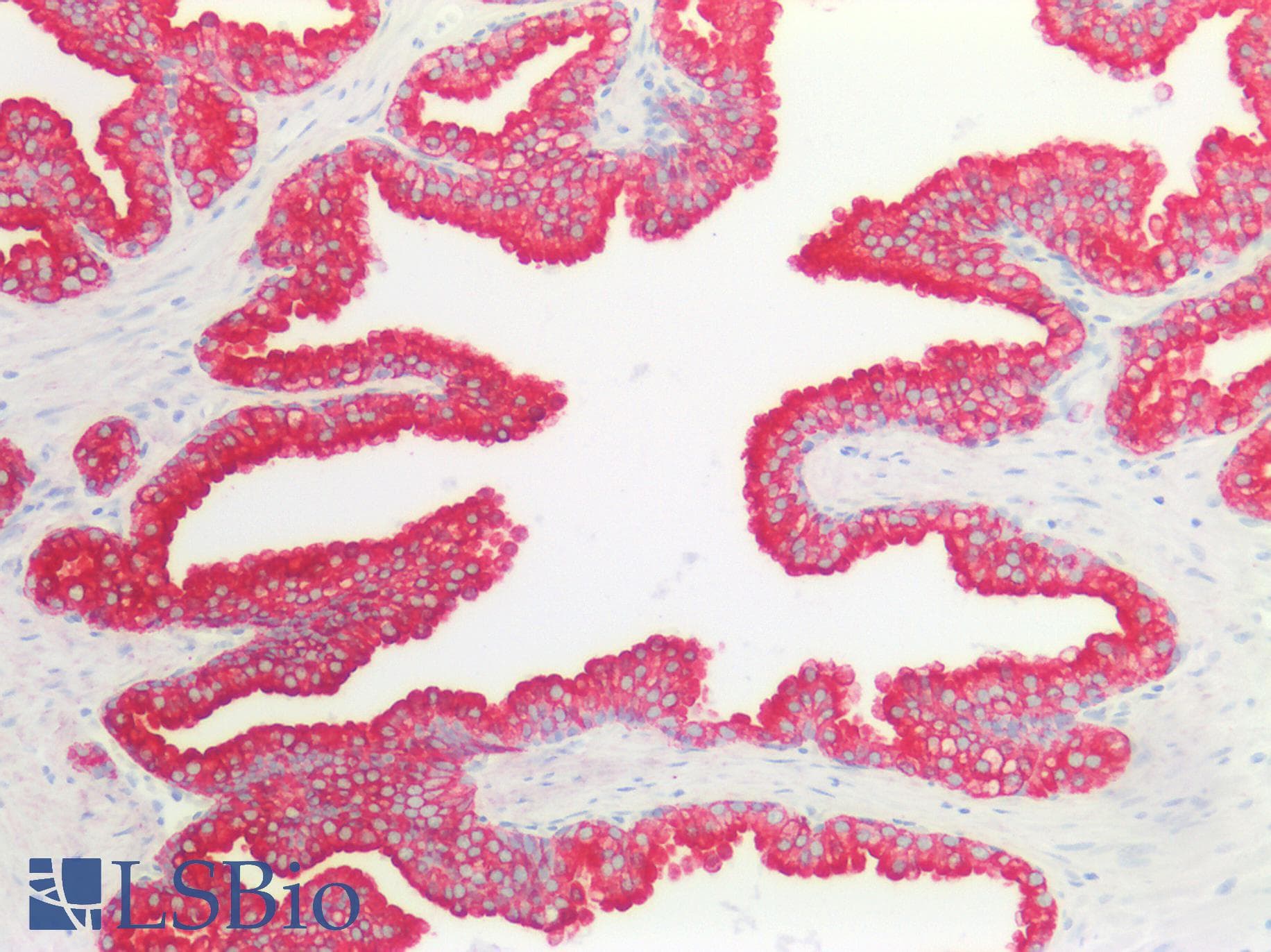 PathPlus™ KRT8 / CK8 / Cytokeratin 8 Antibody