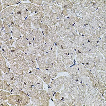 CREBBP / CREB Binding Protein Antibody
