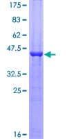 Human RBP4 Protein (Recombinant GST)