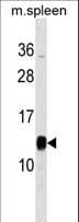 PFDN1 Antibody (aa86-113)