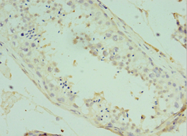 ATF7 Antibody (aa1-117)