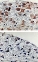 APAF1 / APAF-1 Antibody