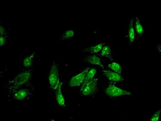 FANCA Antibody