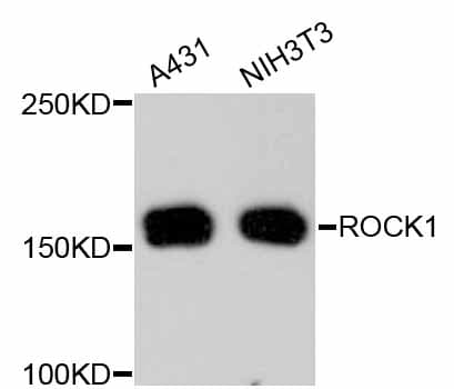 Rho Kinase / ROCK1 Antibody