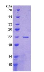 Mouse CD276 / B7-H3 Protein (Recombinant His-T7)