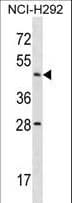 Polyclonal Rabbit anti-Human ACTL7B Antibody (aa69-97, WB)