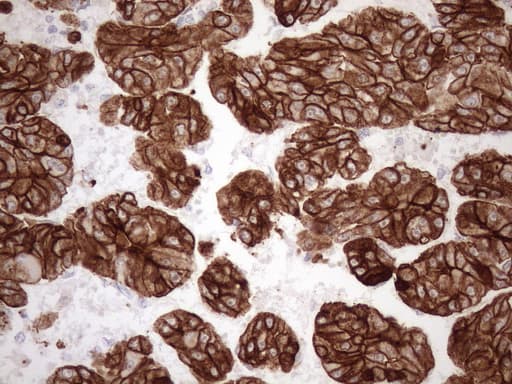 KRT18 / CK18 / Cytokeratin 18 Antibody (aa69-372, clone OTI3D1)