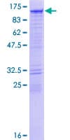 Human DIAPH3 / MDIA2 Protein (Recombinant GST)