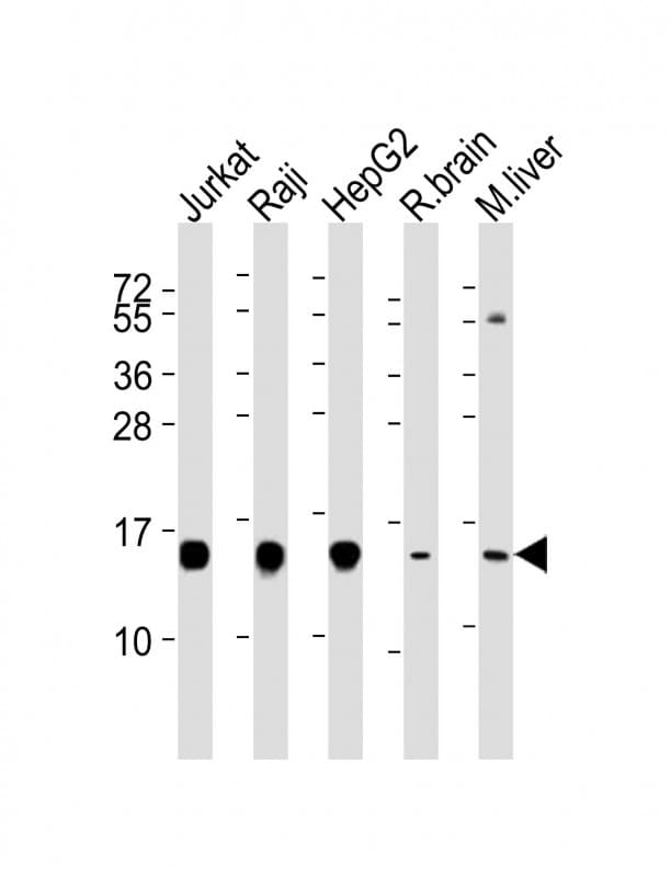 IHC-plus™ HINT / HINT1 Antibody (clone 1500CT836.13.93)