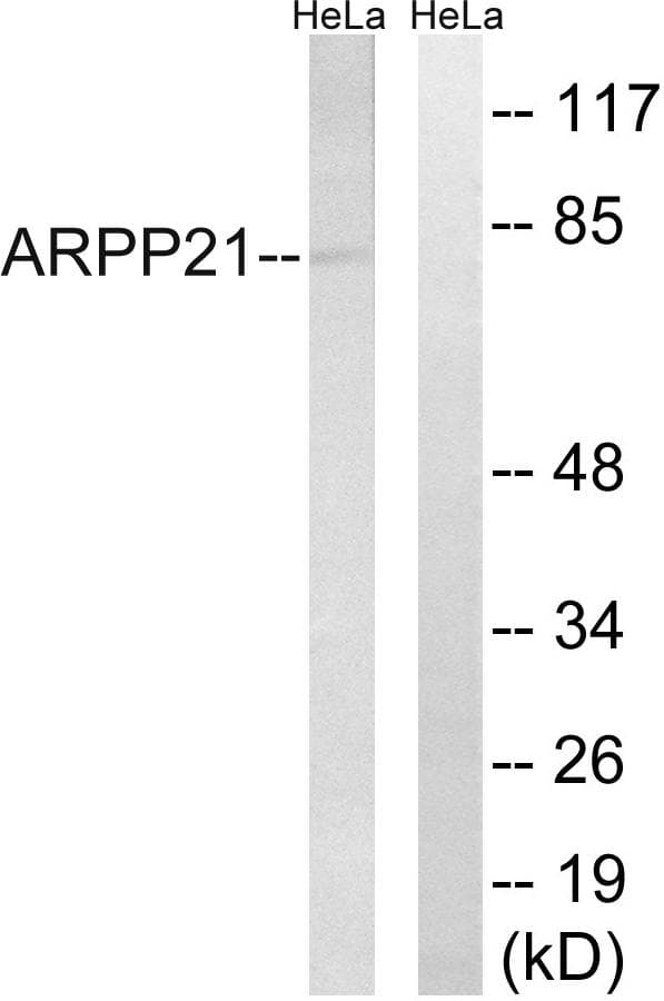 RCS / ARPP-21 Antibody