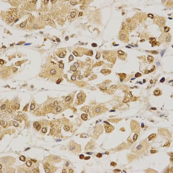 Polyclonal Rabbit anti-Human PDE4D Antibody (IHC, WB)