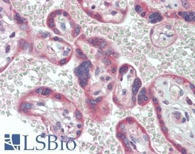 IHC-plus™ CCL13 / MCP4 Antibody