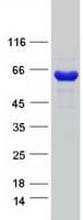 Human CTP Synthetase 2 / CTPS2 Protein (Recombinant Myc-DDK (Flag))