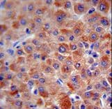 Polyclonal Rabbit anti-Human CFH / Complement Factor H Antibody (aa751-780, IHC, IF, WB)