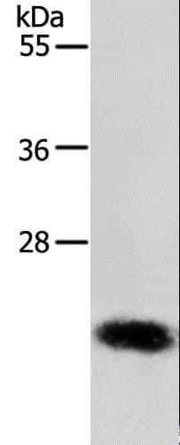 Polyclonal Rabbit anti-Human RAB22A / RAB22 Antibody (IHC, WB)
