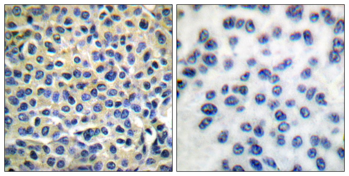 LIMK1 + LIMK2 Antibody (p508/505)