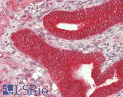 IHC-plus™ YAP / YAP1 Antibody (aa350-400)