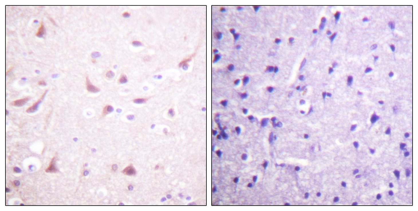 DPYSL2 / CRMP2 Antibody (p514)
