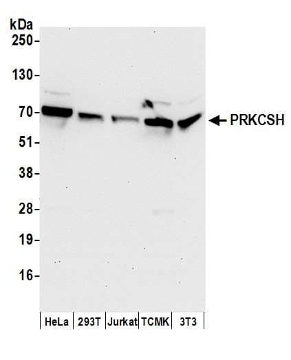 PRKCSH Antibody (aa1-50)
